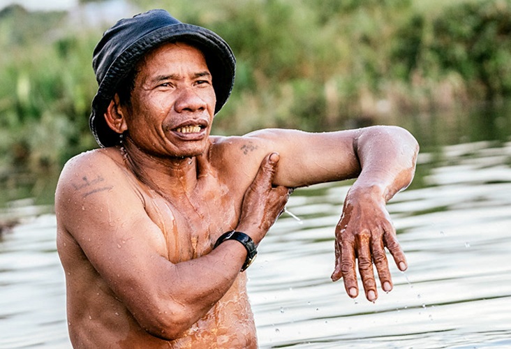 Man Scratching Armpit